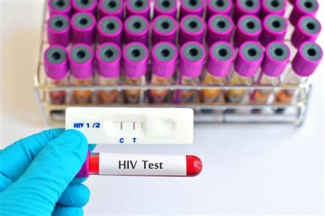 HIV Testing Types Effectiveness And Availability Alpha Nutrition