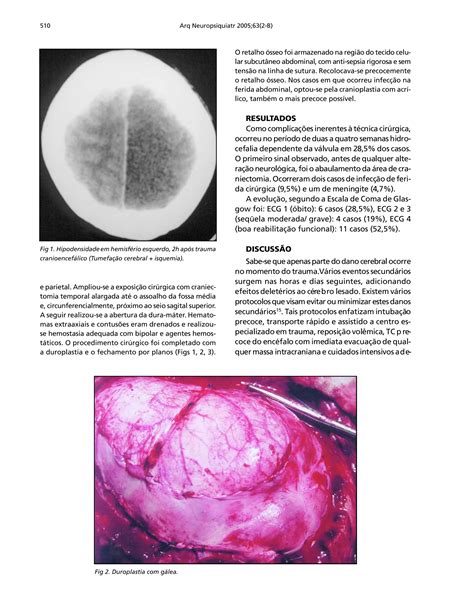 Craniotomia Descompressiva PDF