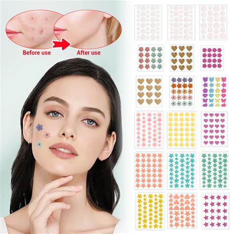 40 Counts Acne Patches Cute Star Shaped Acne Treatment Sticker