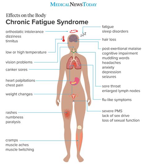 Chronic Fatigue Syndrome Symptoms Treatment And Causes