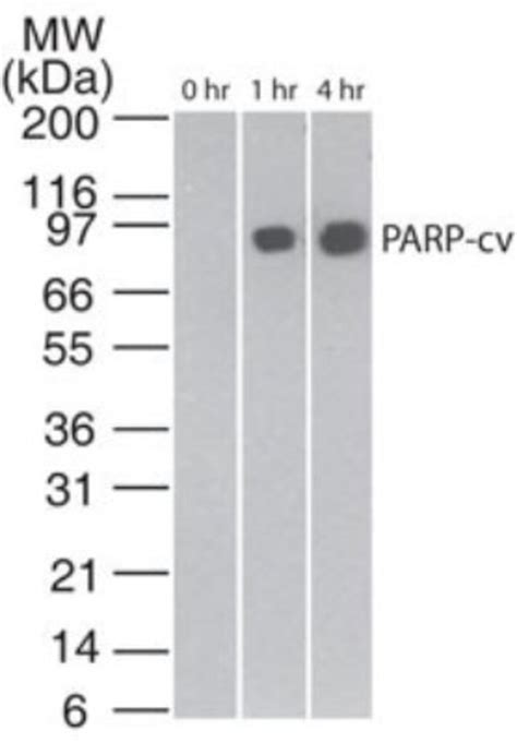 Novus Biologicals™ Apoptosis Detection Antibody Pack 3 Vials Fisher