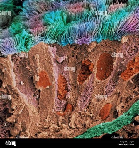 Lung Lining Coloured Scanning Electron Micrograph Sem Of A Section