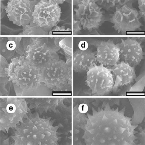 Detailed morphological differences in structure of basidiospore of ...