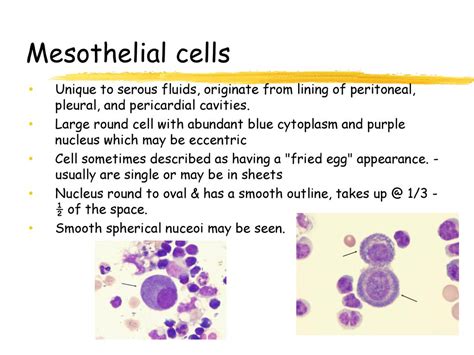 Urinalysis And Body Fluids Crg Ppt Download