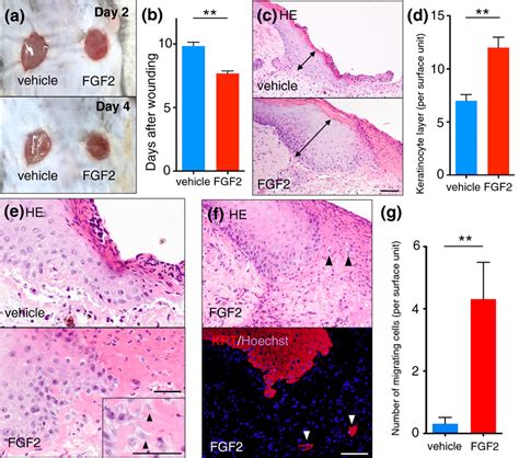 FGF2 Accelerated Wound Healing Epidermal Hypertrophy And Keratinocytes