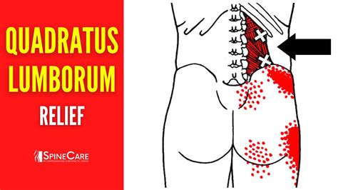 How To Fix Quadratus Lumborum Pain FOR GOOD YouTube