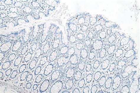 Ihceasy Cd8 Ready To Use Ihc Kit United Bio Research