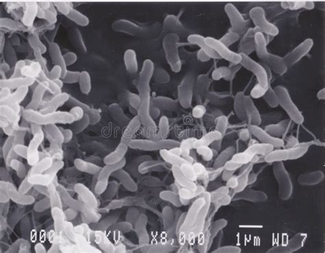 Scanning Electron Microscope Photo of Vibrio Bacteria X5000 Stock Image ...