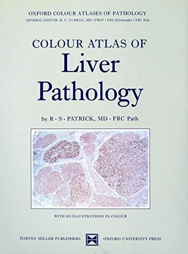 Amazon Color Atlas Of Liver Pathology Oxford Color Atlases Of