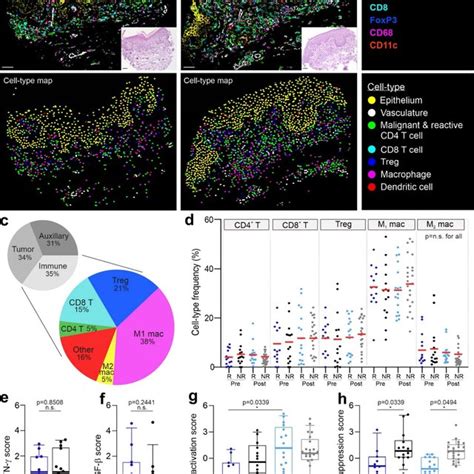 Cellular Neighborhoods Reveal Differences In The Spatial Tme