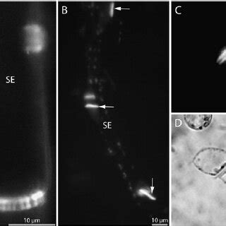 Detection of cell wall cellulose and callose using CW staining on ...