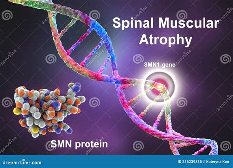 Spinal Muscular Atrophy SMA. Spinal Muscular Atrophy Awareness Month ...