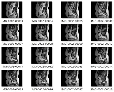 Sample Sci Database With Disease Type Abnormal And Normal Cases Of