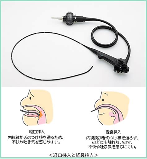 内視鏡検査について：港南台パークサイドクリニック 横浜市港南区・外科・消化器科・内科・整形外科