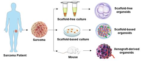 Cancers Free Full Text Patient Derived Organoids As A Promising