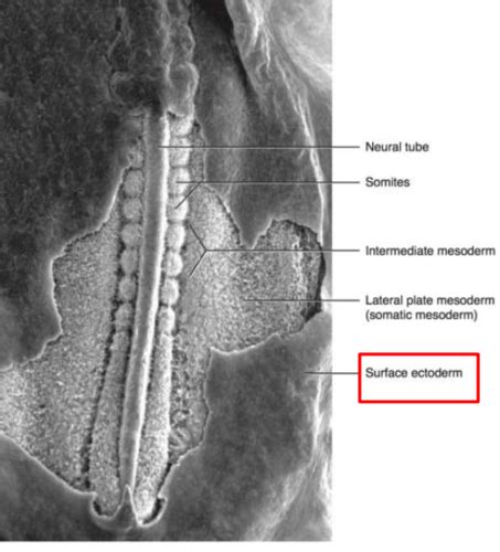 Musculoskeletal Embryo Flashcards Quizlet