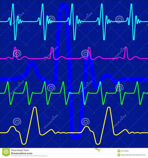 Cardiogram Stock Vector Illustration Of Amplitude Monitor 35734353