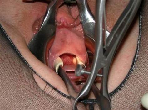 PussymodsgaloreA Vaginal Speculum Holds Her Pussy Open And Then What