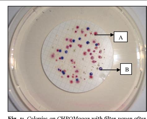 Figure 1 From BACTERIOLOGICAL ANALYSIS OF DRINKING WATER FROM 100