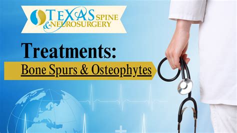 Bone Spurs And Osteophytes Texas Spine And Neurosurgery Minimally