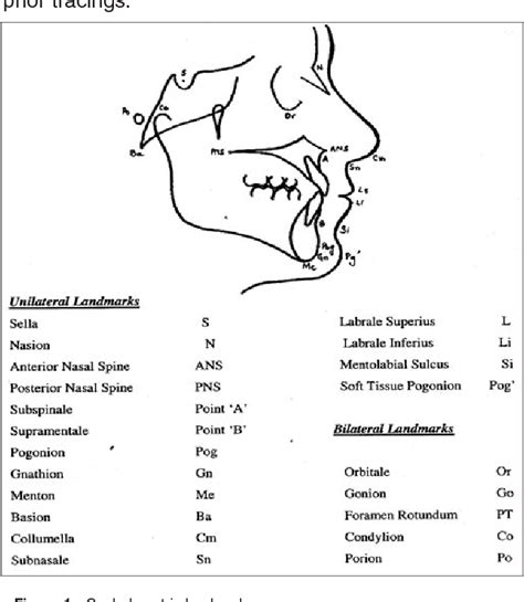 Table I From Comparison Of Cephalometric Norms Of Esthetically Pleasing Faces Semantic Scholar