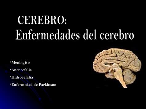 Dia Mundial Del Cerebro Cuales Son Las Enfermedades Mas Comunes Que