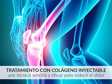 Tratamiento Con Colágeno Iconica Servicios Médicos