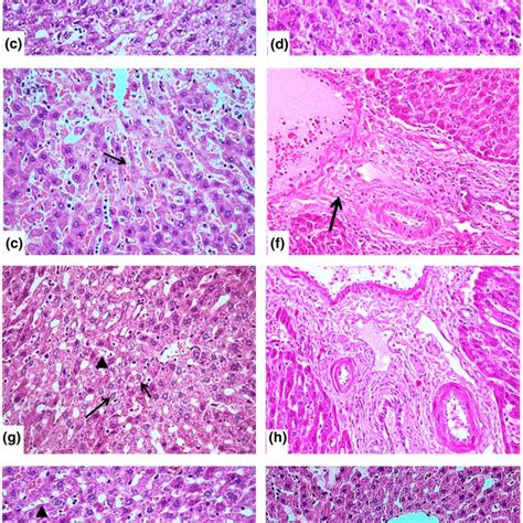 Micrograph Of Liver Rat A Negative Control Group 1 Shows Normal Download Scientific Diagram