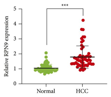 Rpn And Rpn Are Upregulated In Hcc Tissues And Cell Lines A Rpn