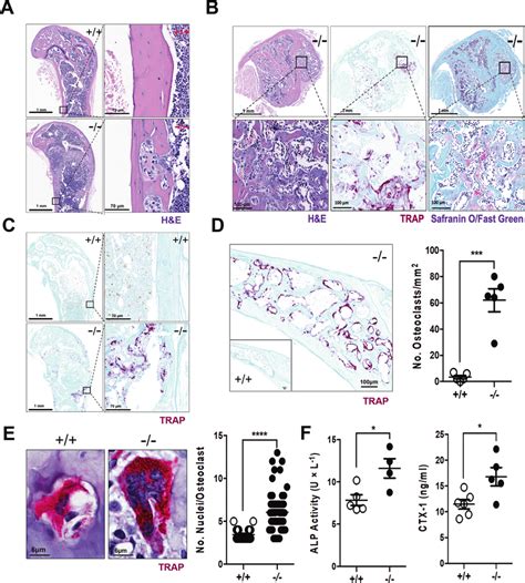 Increased Osteoclastogenesis In Aged Optn Mice A H E Staining Of