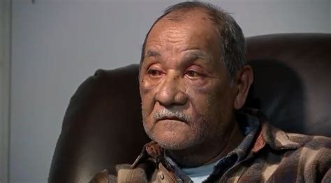 He Thought I Was Dead 78 Year Old Janitor Beaten Allegedly By Naked