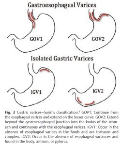 Clasificaciones En Gastroenterolog A Gastro M Rida