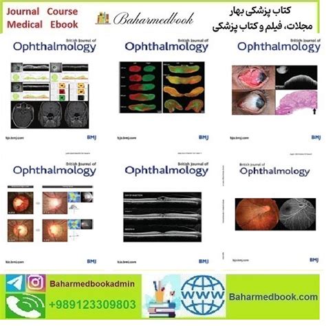 British Journal Of Ophthalmology 2024 Full Archives True Pdf