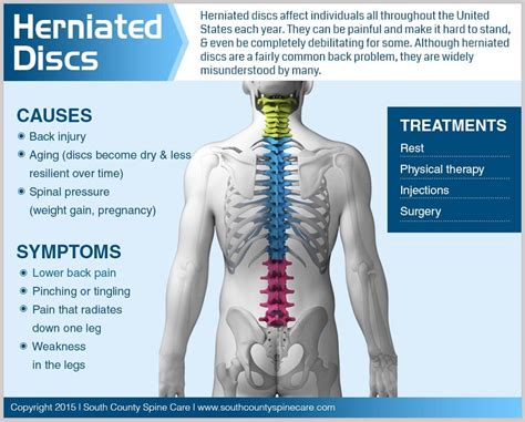 Herniated Discs South County Spine Care Center