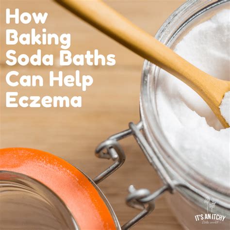 Why Baking Soda Baths for Eczema Can Work!