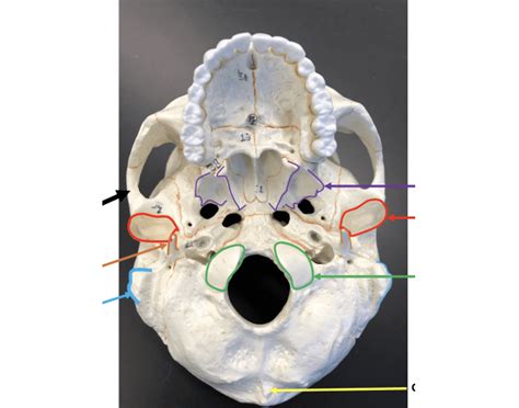 Skull Inferior View Bone Markings — Printable Worksheet