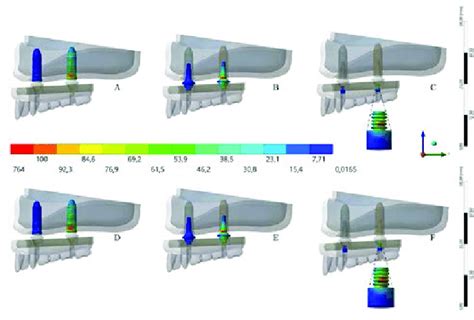 Maps Of Von Mises Stress Distribution Results For Implants Download Scientific Diagram