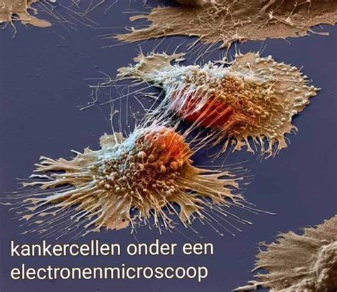 Kankercellen Onder Een Microscoop Hijama En Cupping Rotterdam