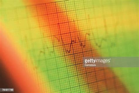 245 Ecg Graph Stock Photos High Res Pictures And Images Getty Images