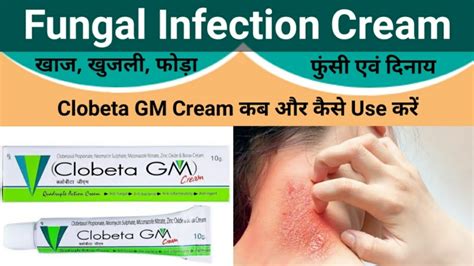 Clobeta Gm Cream Uses In Hindi Clobeta Gm Cream