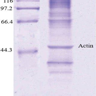 Sds Page Of Myosin Extracted From Fish Muscle Lane Designates