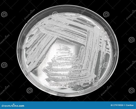 Bacterial Streak Plate