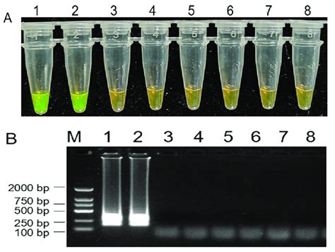 Loop Mediated Isothermal Amplification Lamp Assay On Detection Of