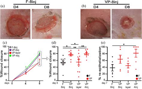 Efficacy Of Intradermal Treatment With TG VEGF TG PDGF BB Decorated