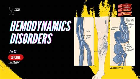 Pathology Lec Hemodynamics Disorders Edema Hyperemia And