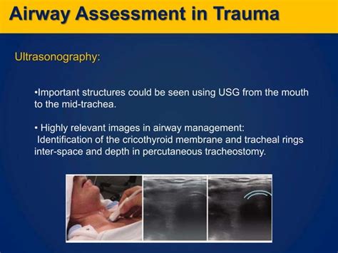 Airway Management In Trauma Patients Ppt