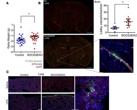 Jci Insight Endothelial Socs Maintains Homeostasis And Promotes