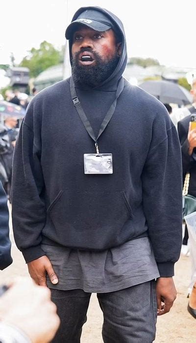 Kanye West Leaves Fans Stunned With Bruised Appearance During Paris Fashion Week