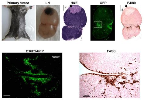 Histopathological Analysis Of A Metastatic Lymph Nodes From A B F Gfp