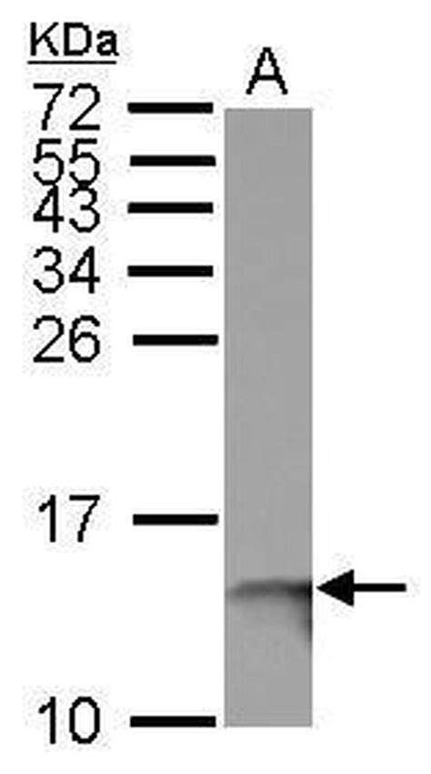 Beta 2 Microglobulin Polyclonal Antibody Pa5 29580